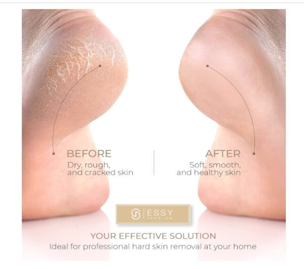 Essy Electric Foot File - Image 2