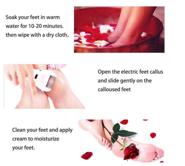 Swhily electric callus remover - Image 2