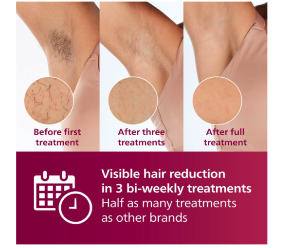 Philips Lumea Hair Removal 7000 - Image 4