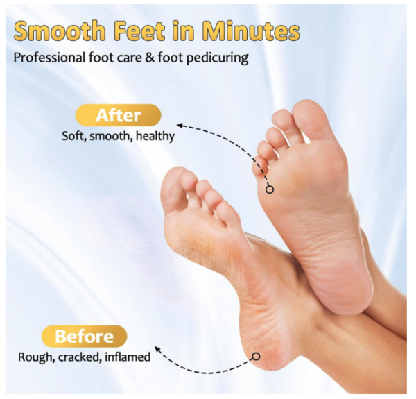 iMoebel ZCA069 electric callus remover - Image 6